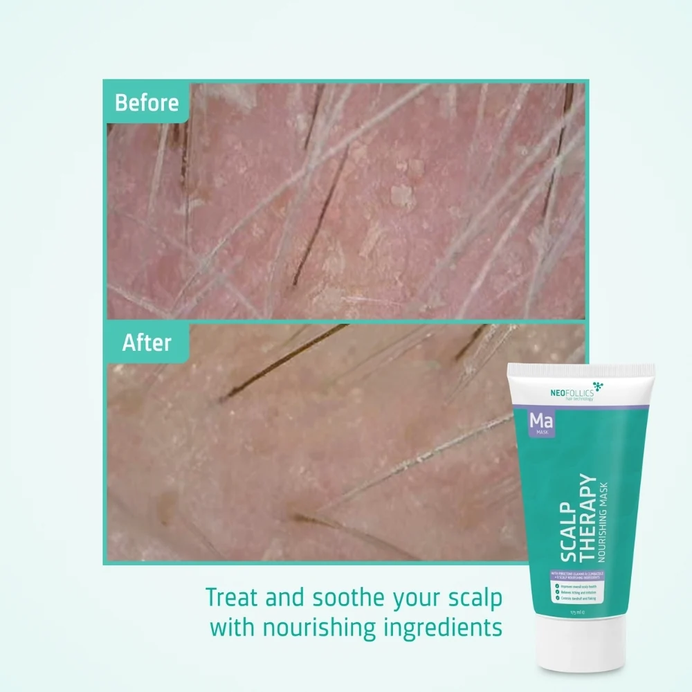 Neofollics nourishing mask - Image 3